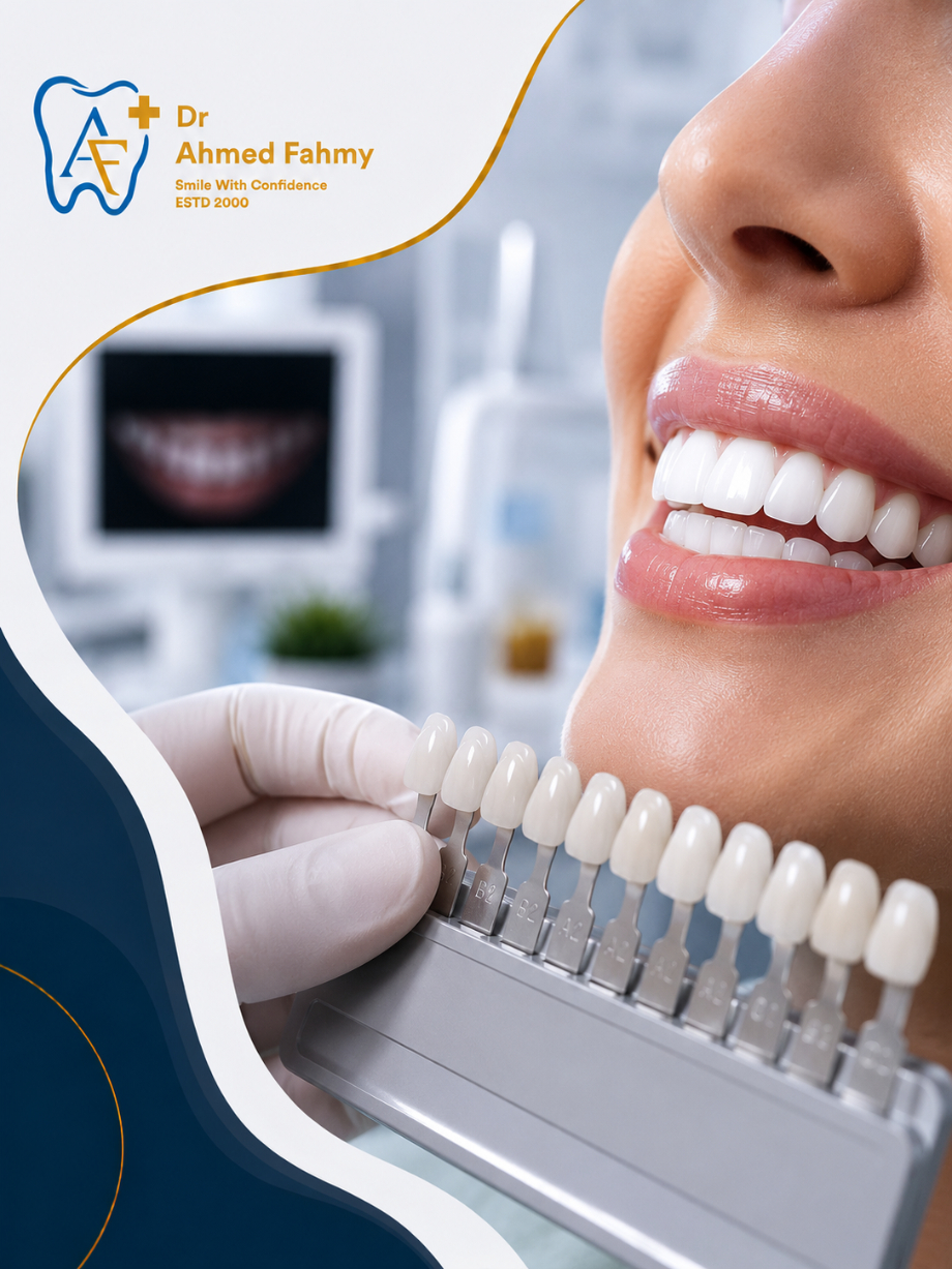 Hollywood Smile