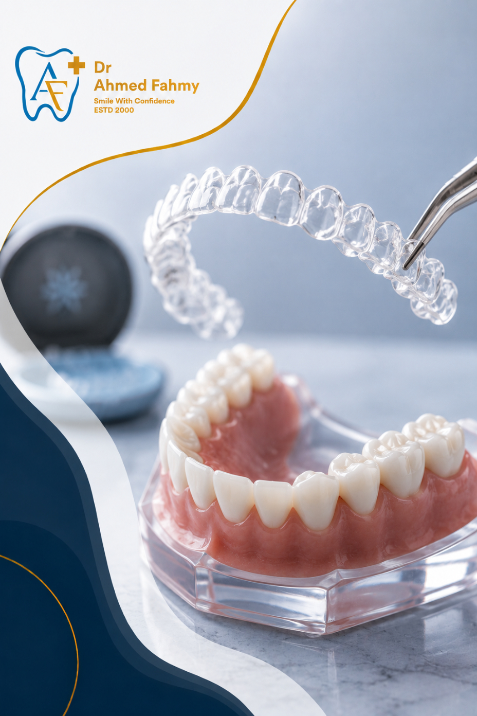 Clear Aligners
