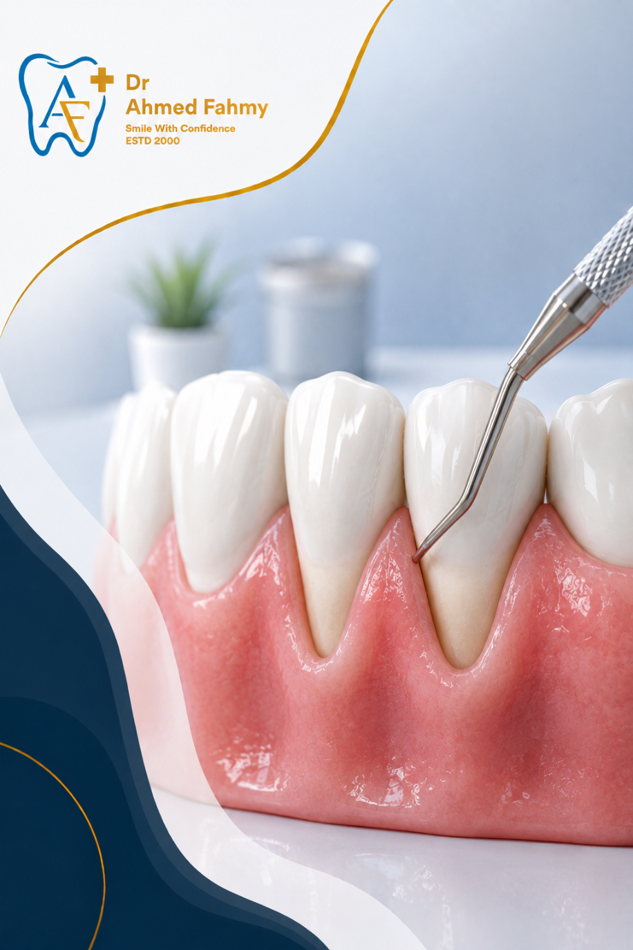 Gum Depigmentation